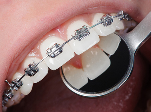 orthodontic